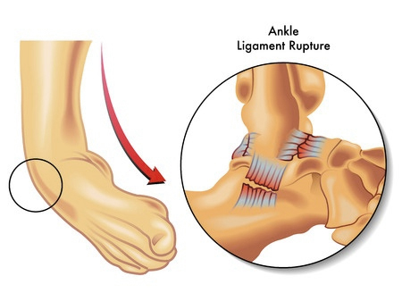 Pallisree Cricket Blog | How to deal with the Common Cricket Injuries